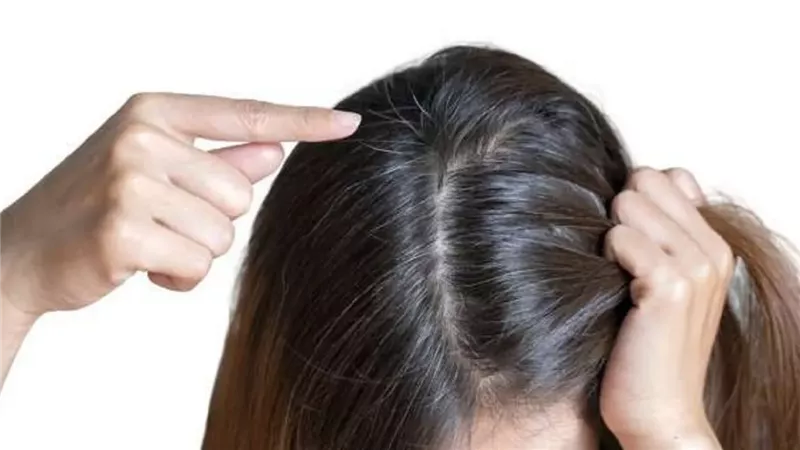 5 وصفات مذهله لعلاج تساقط الشعر وإعادة نموه ونتائجها سريعة جدا 