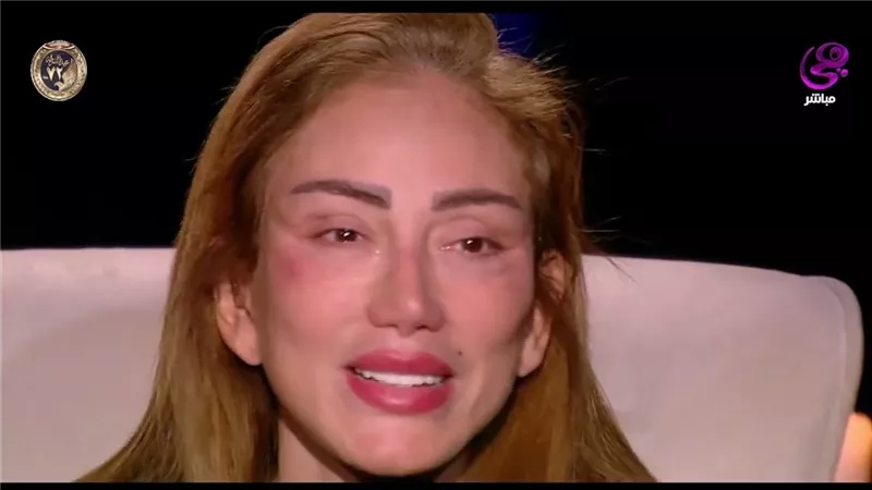 شوهتنى منك لله .. ريهام سعيد توجه رسالة جديدة وغــريبة  لطبيب التجميل اللبنانى