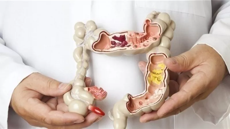 كل مشاكل القولون هتخلص فى ثانية.....كل ما عليك اتباع تلك العادات اليومية الخمسة