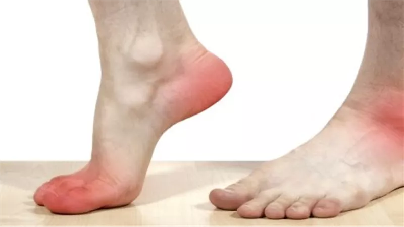 انتبه لـ القدمين.. أعراض لو ظهرت فتأكد أن جسدك يستغيث من أمراض خطيرة.. اعرف التفاصيل