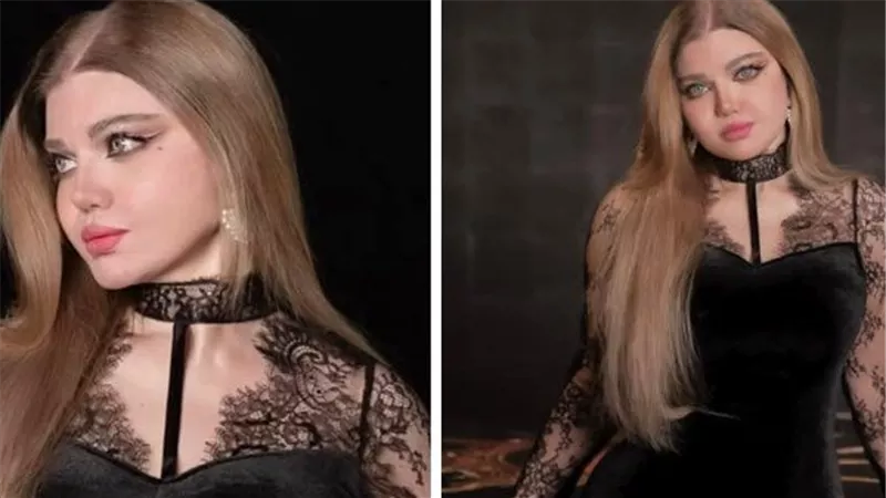 اعرف المرض الذي تعاني منه ياسمين الخطيب جعلها تتوقف عن الظهور في برنامجها