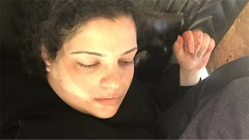 أول صور للمتهم في واقعة طعن سيدتين في منطقة عزبة النخل