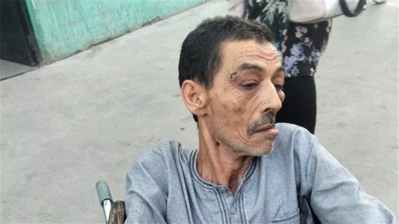 تقرير طبي يكشف إصابات مسن بعد الاعتداء عليه بسبب خلافات نسب بحلوان