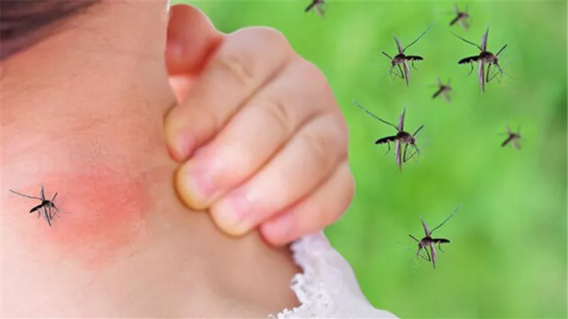 طبيب أطفال يحذر من الحساسية الحشرية ولدغات الناموس صيفًا وأعراض تستدعي الكشف