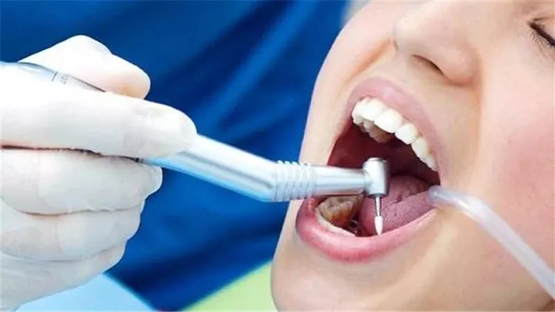 إلغاء اشتراط ترخيص أجهزة الأشعة الصغيرة داخل عيادات الأسنان والنقابة تكشف موقف النيتروز